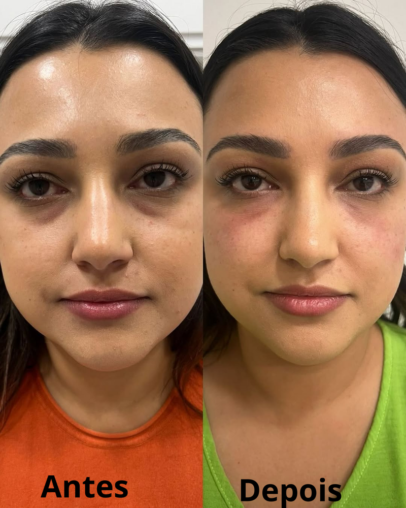 Creme para os Olhos – Resultados Visíveis Já na Primeira Aplicação!